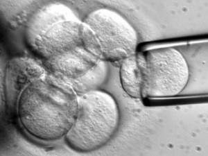 Терапию стволовыми клетками начали испытывать на пациентах с инсультом