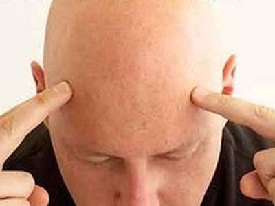 Лысый? Проверь сердце