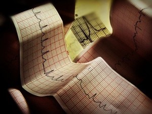Современные стратегии в кардиологии