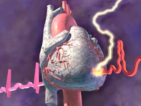 Применение нитратов у больных хронической ишемической болезнью сердца