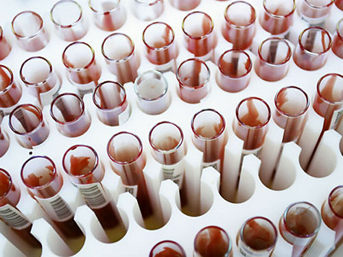 Кровь поможет определить сердечный приступ