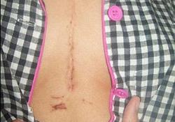 Сердечный клапан от свинки и вегетарианство – понятия совместимые