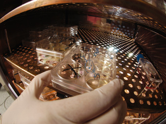 Доказана эффективность лечения инфаркта стволовыми клетками