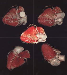 Магнитно-резонансное исследование сердца: дополнительные аргументы «за»