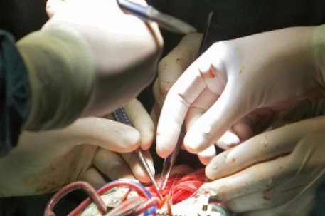 Тысячная операция на открытом сердце