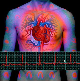 Антиаритмические эффекты барокамерной гипоксии у постинфарктных больных с начальными стадиями хронической сердечной недостаточности