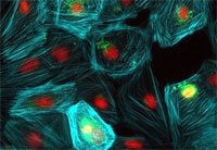 Новая технология стволовых клеток обещает изобилие ключевых сердечных клеток