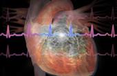 Трансплантация стволовых клеток может спровоцировать развитие заболеваний сердца