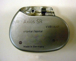 Кардиостимулятор: сердца пламенного мотор