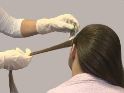 Лечение педикулеза в домашних условиях
