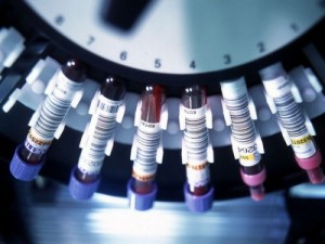 Новый анализ крови прогнозирует шансы развития у человека сердечных болезней и диабета