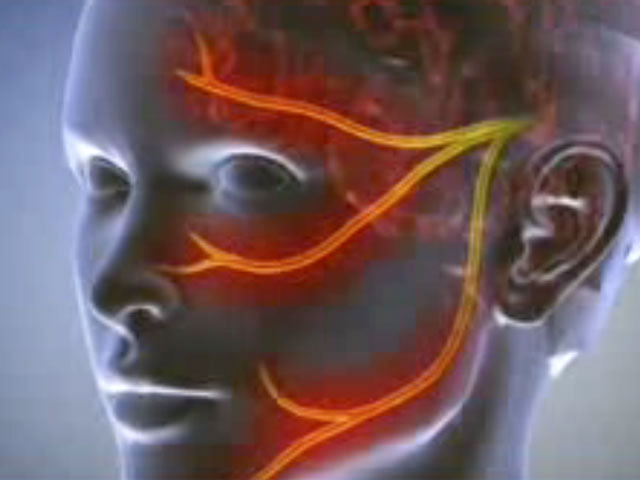 Виды и симптомы невралгии