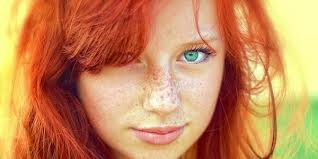 Веснушки – проблема или нет?