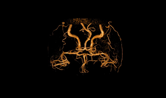 Современные методы диагностики функций головного мозга