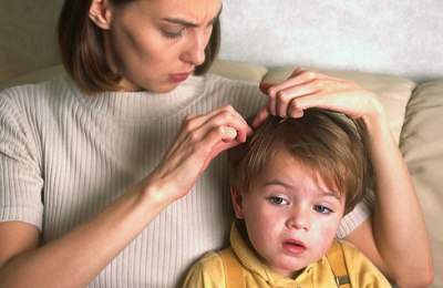 Как избавиться от вшей