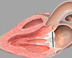 Аномалии митрального клапана
