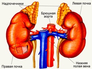 Вторичная гипертония. Поражение почек