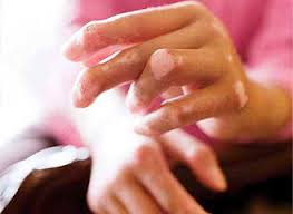 Поражение сердца при системных болезнях соединительной ткани