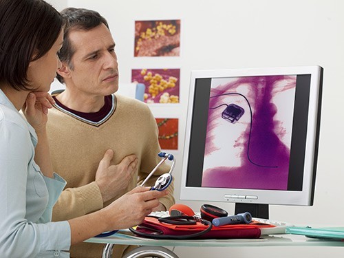 Пациентам предложили проводить «тест-драйв» кардиостимулятора перед его установкой