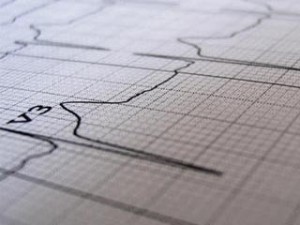 Врожденные пороки сердца