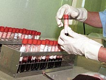 Анализ крови позволит выявить почечную недостаточность у гипертоников