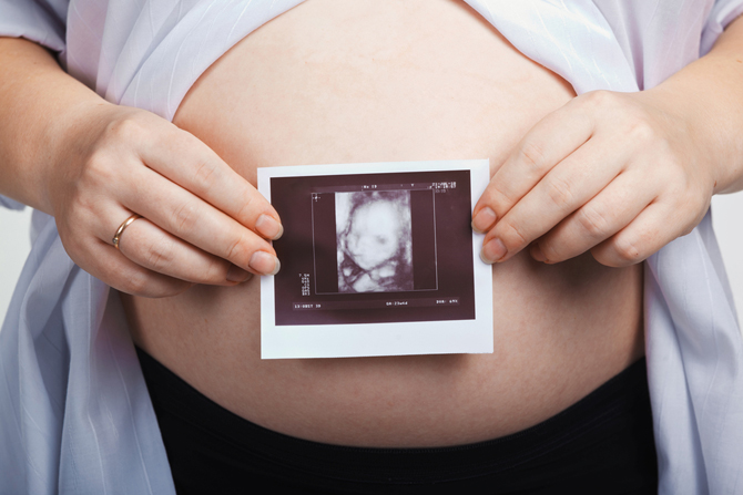 УЗИ для беременных: ответы на самые популярные вопросы будущих мам