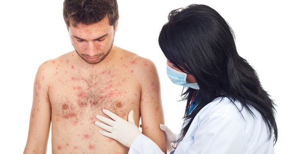 Современное лечение заболеваний кожи