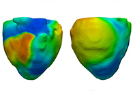 Виртуальная модель сердца поможет вылечить сердечную недостаточность