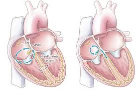 Синусовая тахикардия (Дифференциальный диагноз)