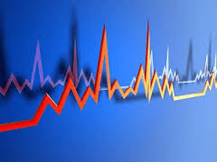 Атриовентрикулярная (узловая) пароксизмальная тахикардия