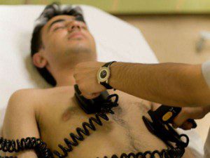 Предсердная тахикардия с атриовентрикулярной блокадой