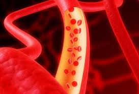 Возраст артерий напрямую связан с риском рака и болезней почек