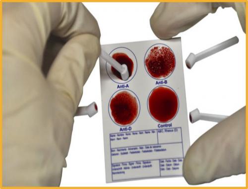 Определение группы крови с помощью уникального теста спасет миллионы жизней