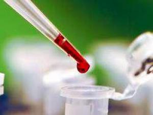 Свободные радикалы могут быть полезны для сердца