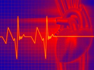 Тахикардия: 6 натуральных средств для нормализации сердечного ритма