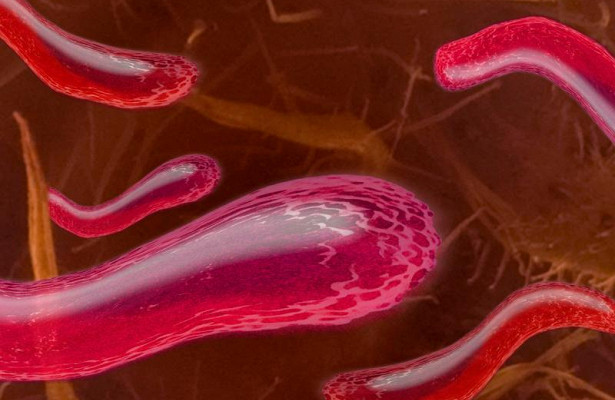 Кишечные бактерии —причина развития атеросклероза
