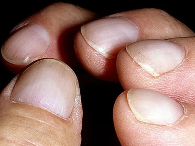 Названы четыре внешних признака, которые указывают на проблемы с сердцем