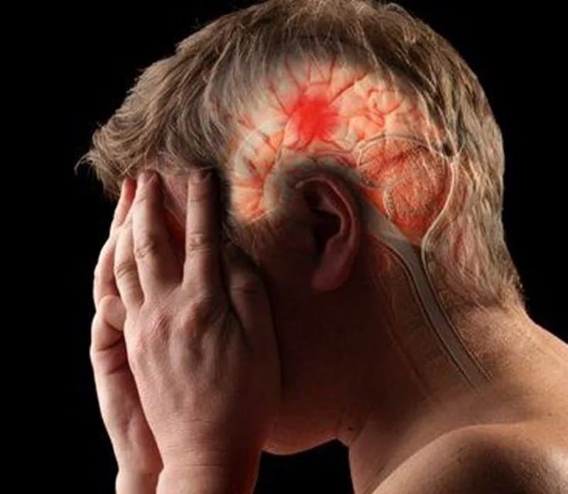 Инсульт, аневризма, рак мозга: как их определить по головной боли?