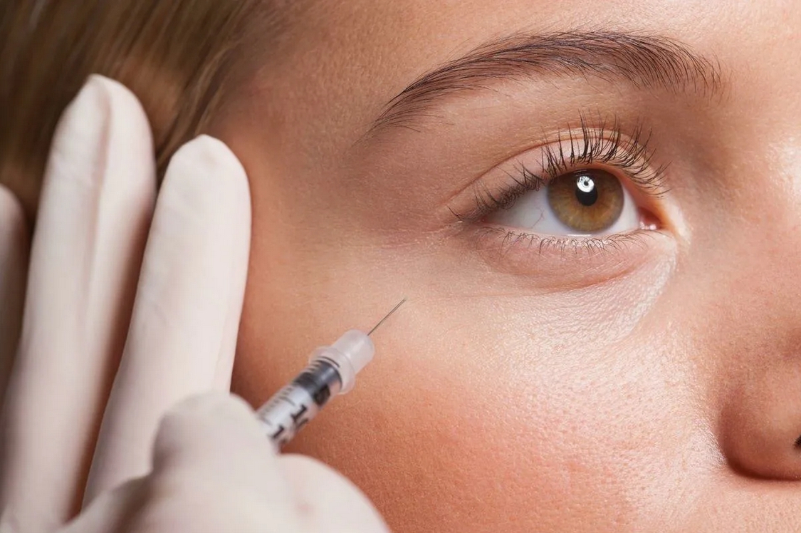 Процедура мезотерапии вокруг глаз
