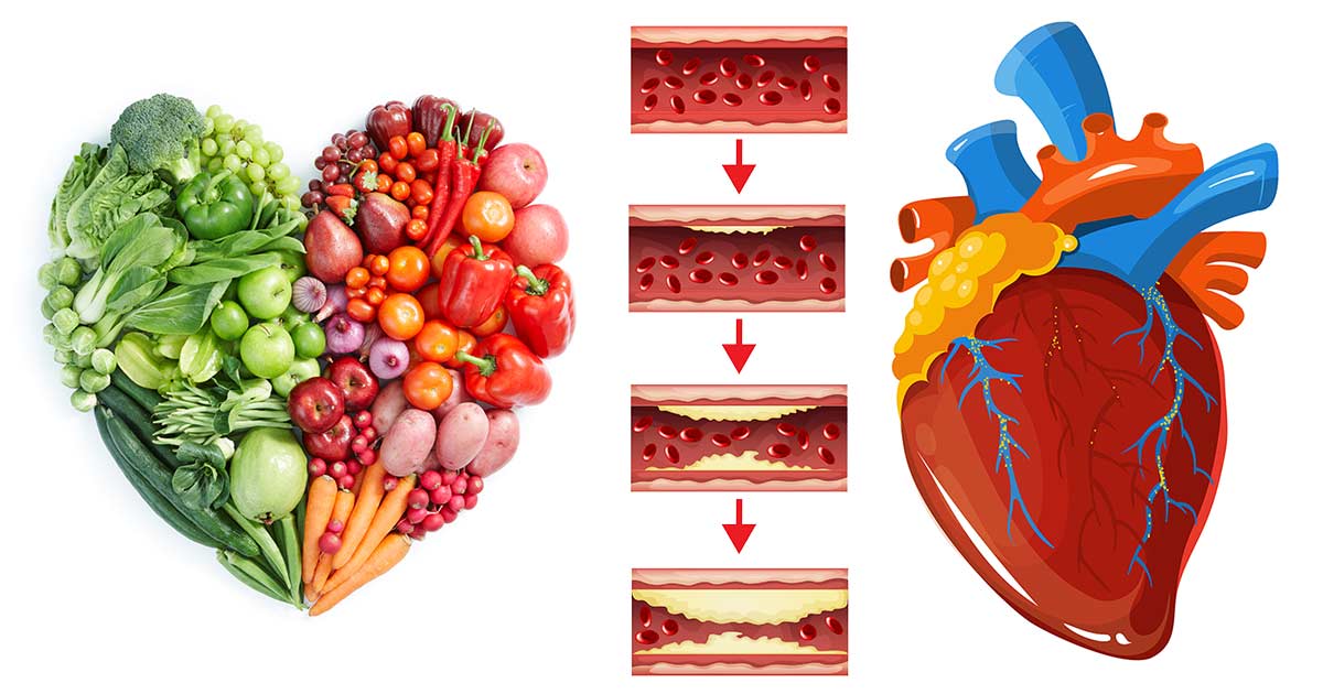 Исследования эффективности диет при атеросклерозе и коронарной болезни сердца