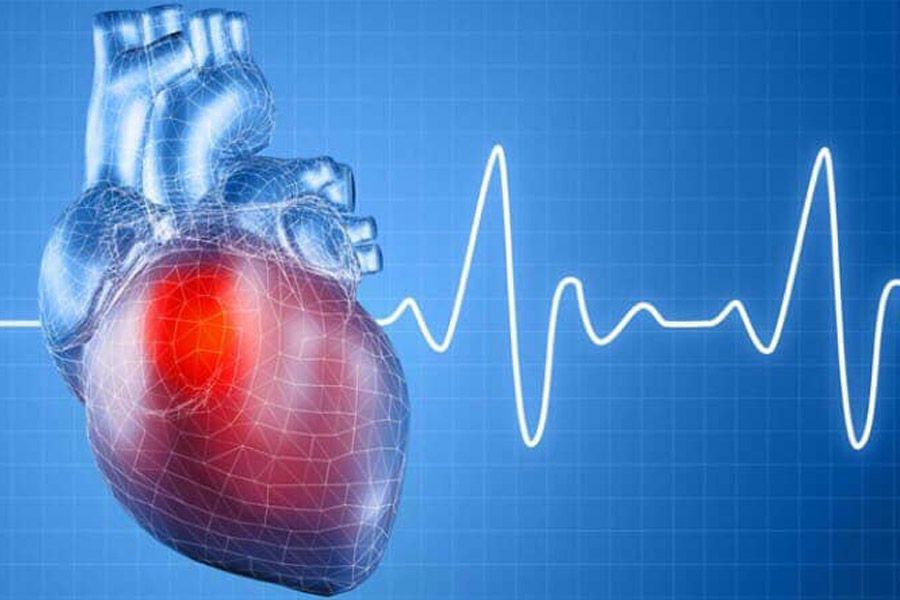 Аритмия сердца: лечение, симптомы и причины развития