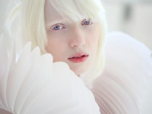 Распространенность альбинизма