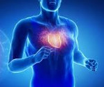Синдром спортивного сердца