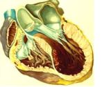 Морфология миокарда при внезапной сердечной смерти (ВСС)