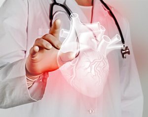 Сердечная МРТ при аритмогенной правожелудочковой кардиомиопатии