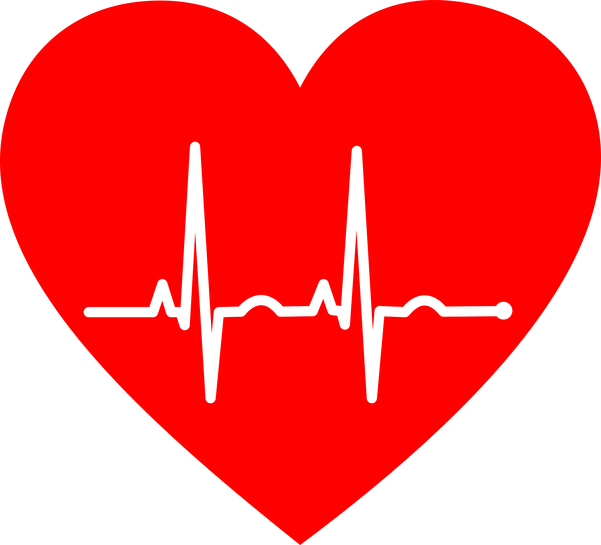 Диагностика шунтов крови при катетеризации сердца