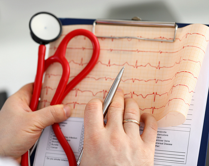 Эффекты ускоренной кардиостимуляции у пациентов с ХСНсФВ