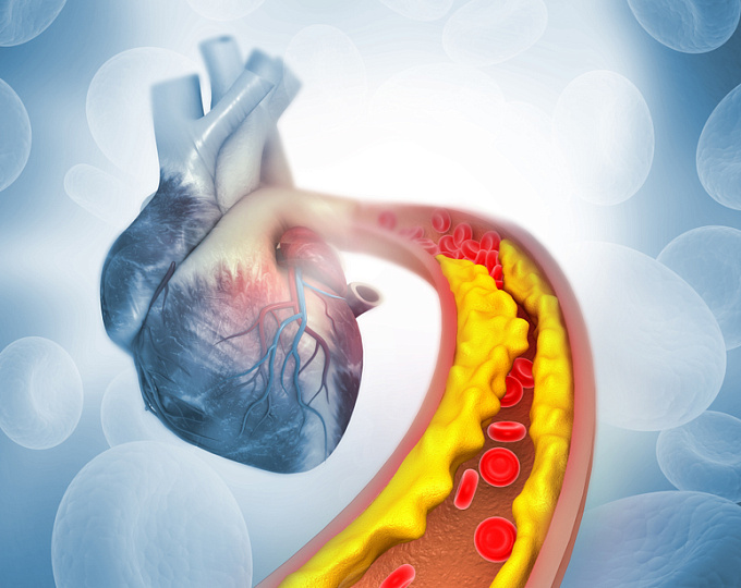 Меры профилактики остановки сердца при заболеваниях сердца