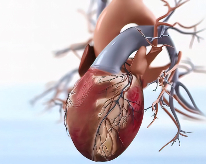 Методы выявления атеросклеротической бляшки и их значение в скрининге сердечно-сосудистых заболеваний