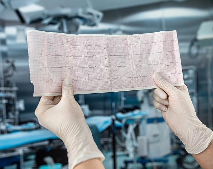 Обладают ли иНГЛТ-2 кардиопротективными свойствами при терапии антрациклинами?